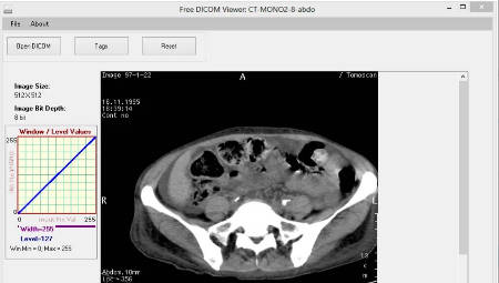 dicom viewer